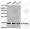 Small Nuclear Ribonucleoprotein D2 Polypeptide antibody, A4120, ABclonal Technology, Western Blot image 
