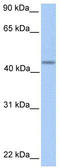Patatin Like Phospholipase Domain Containing 5 antibody, TA329580, Origene, Western Blot image 