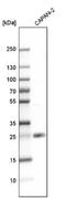 Toll Like Receptor Adaptor Molecule 2 antibody, NBP1-90949, Novus Biologicals, Western Blot image 