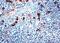 Serpin Family A Member 3 antibody, NB120-9374, Novus Biologicals, Immunohistochemistry paraffin image 
