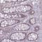 Notch Receptor 2 antibody, NBP2-48913, Novus Biologicals, Immunohistochemistry frozen image 
