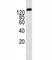 ATP Binding Cassette Subfamily B Member 1 antibody, F49437-0.4ML, NSJ Bioreagents, Western Blot image 