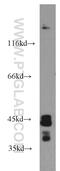 Sirtuin 2 antibody, 15345-1-AP, Proteintech Group, Western Blot image 