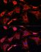 Interleukin 1 Receptor Associated Kinase 1 antibody, LS-C747718, Lifespan Biosciences, Immunofluorescence image 