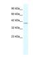 Phosphorylase Kinase Catalytic Subunit Gamma 2 antibody, NBP1-54866, Novus Biologicals, Western Blot image 