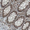 DNA excision repair protein ERCC-1 antibody, AMAb90872, Atlas Antibodies, Immunohistochemistry paraffin image 