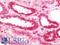 Ferrochelatase, mitochondrial antibody, LS-B11573, Lifespan Biosciences, Immunohistochemistry paraffin image 