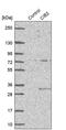 Calcium And Integrin Binding Family Member 2 antibody, PA5-57776, Invitrogen Antibodies, Western Blot image 