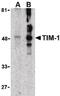 Hepatitis A Virus Cellular Receptor 1 antibody, PA5-20244, Invitrogen Antibodies, Western Blot image 