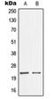 NME/NM23 Nucleoside Diphosphate Kinase 1 antibody, orb214321, Biorbyt, Western Blot image 