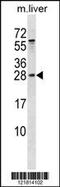 RAB5B, Member RAS Oncogene Family antibody, 59-976, ProSci, Western Blot image 