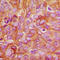 Protein Kinase C Delta antibody, LS-C352716, Lifespan Biosciences, Immunohistochemistry paraffin image 