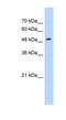 3-Hydroxy-3-Methylglutaryl-CoA Synthase 2 antibody, NBP1-54869, Novus Biologicals, Western Blot image 