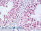 RAN Binding Protein 9 antibody, 46-265, ProSci, Immunohistochemistry frozen image 