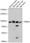 Phosphodiesterase 8A antibody, A05304, Boster Biological Technology, Western Blot image 
