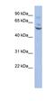 ETS Variant 1 antibody, orb329990, Biorbyt, Western Blot image 