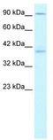 Kinesin Family Member C2 antibody, TA334705, Origene, Western Blot image 