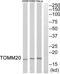 Translocase Of Outer Mitochondrial Membrane 20 antibody, PA5-39247, Invitrogen Antibodies, Western Blot image 