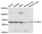 Interleukin 1 Receptor Like 2 antibody, STJ112130, St John