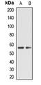 Tryptophan Hydroxylase 2 antibody, LS-C668907, Lifespan Biosciences, Western Blot image 