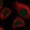 Mtr4 Exosome RNA Helicase antibody, NBP1-84995, Novus Biologicals, Immunofluorescence image 