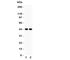RUNX Family Transcription Factor 3 antibody, R31777, NSJ Bioreagents, Western Blot image 