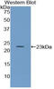 CD79a antibody, LS-C294569, Lifespan Biosciences, Western Blot image 