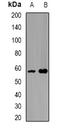 Sperm Adhesion Molecule 1 antibody, orb340823, Biorbyt, Western Blot image 