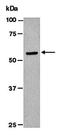 Matrix Metallopeptidase 13 antibody, orb66813, Biorbyt, Western Blot image 