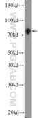 Nuclear Receptor Subfamily 1 Group D Member 2 antibody, 13906-1-AP, Proteintech Group, Western Blot image 