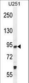 Lysine Acetyltransferase 2B antibody, LS-C163403, Lifespan Biosciences, Western Blot image 