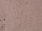 BCL2 Associated Agonist Of Cell Death antibody, A03520S91, Boster Biological Technology, Immunohistochemistry paraffin image 