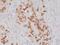 Pulmonary surfactant-associated protein A2 antibody, M04967, Boster Biological Technology, Immunohistochemistry frozen image 