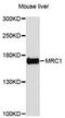 Mannose Receptor C-Type 1 antibody, A11816, ABclonal Technology, Western Blot image 