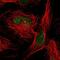 Small Ubiquitin Like Modifier 2 antibody, NBP2-46758, Novus Biologicals, Immunocytochemistry image 