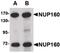 Nucleoporin 160 antibody, PA5-20565, Invitrogen Antibodies, Western Blot image 