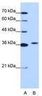 Exosome Component 7 antibody, TA343821, Origene, Western Blot image 