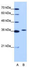 Exosome complex exonuclease RRP42 antibody, TA343821, Origene, Western Blot image 