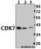 Cyclin Dependent Kinase 7 antibody, A00552, Boster Biological Technology, Western Blot image 