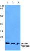 Defensin Beta 4B antibody, A04398, Boster Biological Technology, Western Blot image 