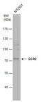 Ecdysoneless Cell Cycle Regulator antibody, GTX115619, GeneTex, Western Blot image 