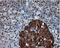 ATP Citrate Lyase antibody, NBP2-02410, Novus Biologicals, Immunohistochemistry paraffin image 