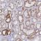 AceCS2 antibody, NBP2-30612, Novus Biologicals, Immunohistochemistry frozen image 