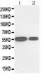 Cytochrome P450 Family 2 Subfamily E Member 1 antibody, PA5-79131, Invitrogen Antibodies, Western Blot image 
