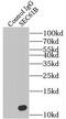 SEC61 Translocon Beta Subunit antibody, FNab07689, FineTest, Immunoprecipitation image 