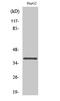 Calcium Voltage-Gated Channel Auxiliary Subunit Gamma 7 antibody, A12584, Boster Biological Technology, Western Blot image 