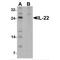 Interleukin 22 antibody, MBS153464, MyBioSource, Western Blot image 