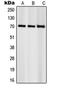 Ribosomal Protein S6 Kinase B1 antibody, orb214537, Biorbyt, Western Blot image 