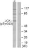 LCK Proto-Oncogene, Src Family Tyrosine Kinase antibody, LS-C117405, Lifespan Biosciences, Western Blot image 