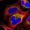 NAD-dependent malic enzyme, mitochondrial antibody, HPA008247, Atlas Antibodies, Immunofluorescence image 